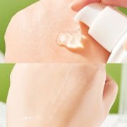 Azelaik Asit Temizleme Losyonu 100g