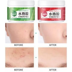 Salisilik Asitli Onarıcı Pamuk Ped 2ml*55