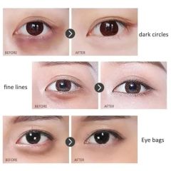 Kırışıklık Karşıtı& Sıkılaştırıcı Göz Altı Bakım Serumu 20ml