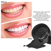 Aktif Kömür Tozu - Diş Beyazlatıcı